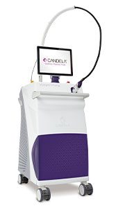 VビームPrimaレーザー