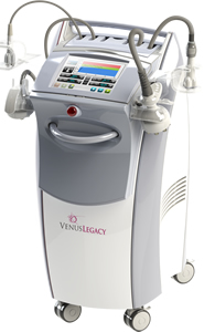 ヴィーナス・レガシー