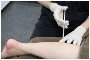 ふくらはぎボトックス