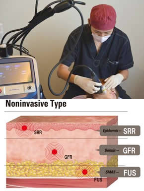 ULTRAcel【ウルトラセル】
